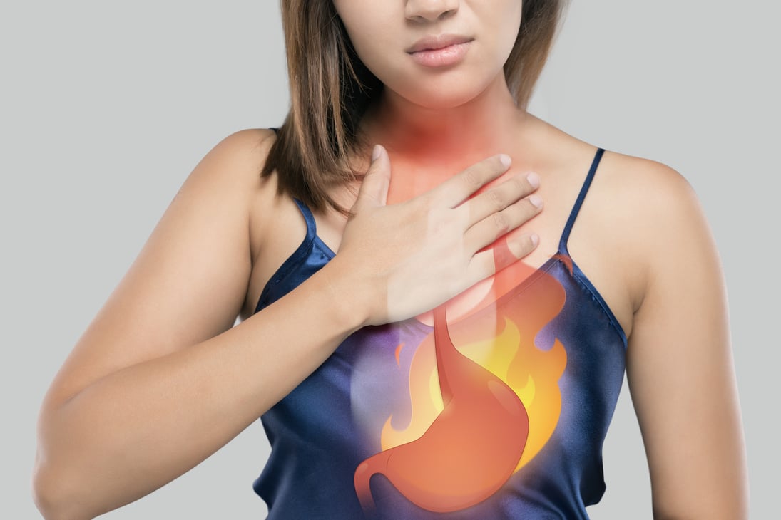 The Photo Of Cartoon Stomach On Woman's Body Against White Background, Acid Reflux Disease Symptoms Or Heartburn, Concept With Healthcare And Medicine